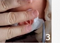 Adhesive strips being removed during application